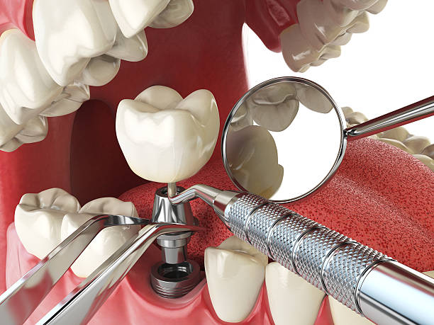 Best Cosmetic Emergency Dentistry in Argyle, TX